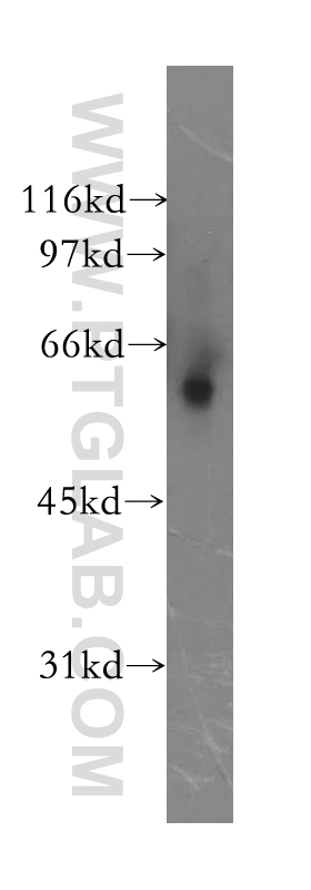 Alpha 2-Antiplasmin