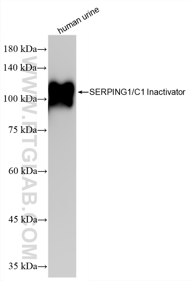 WB analysis of human urine using 82731-1-RR