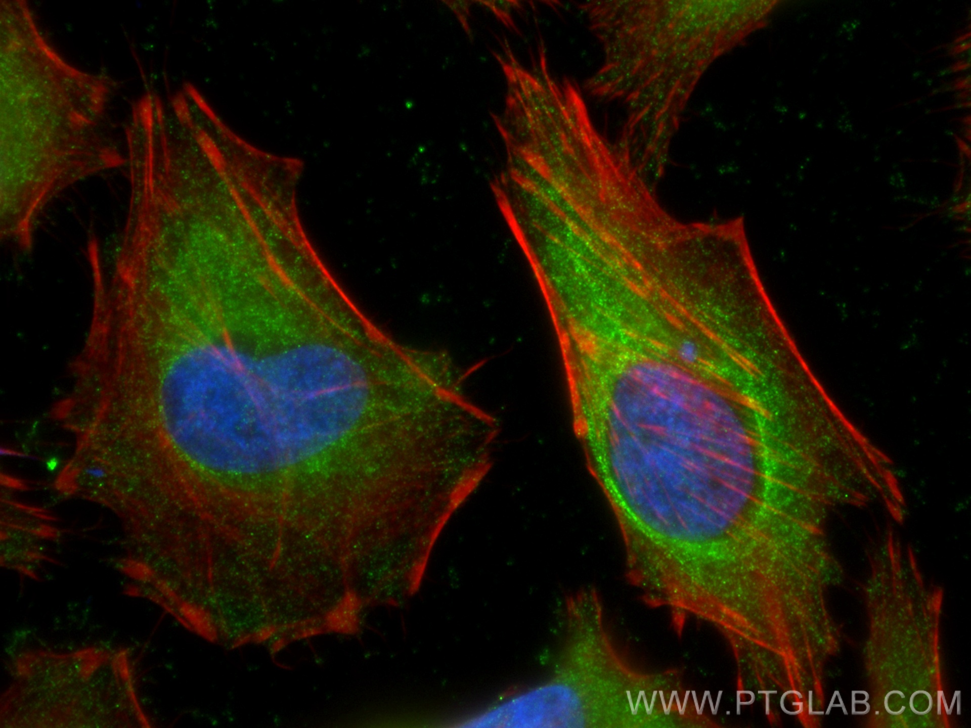 IF Staining of HeLa using 66882-1-Ig