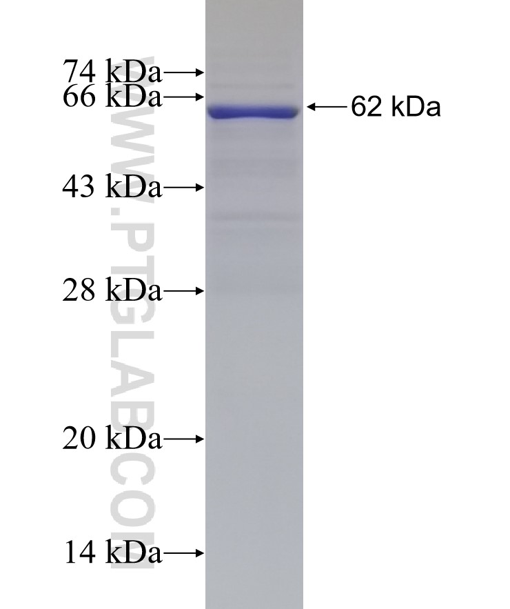 SERPING1 fusion protein Ag2819 SDS-PAGE