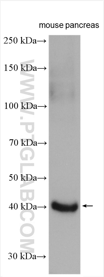 WB analysis of mouse pancreas using 13298-1-AP