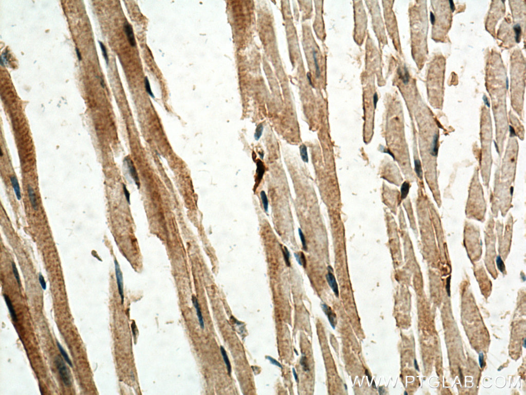 IHC staining of mouse heart using 10167-1-AP