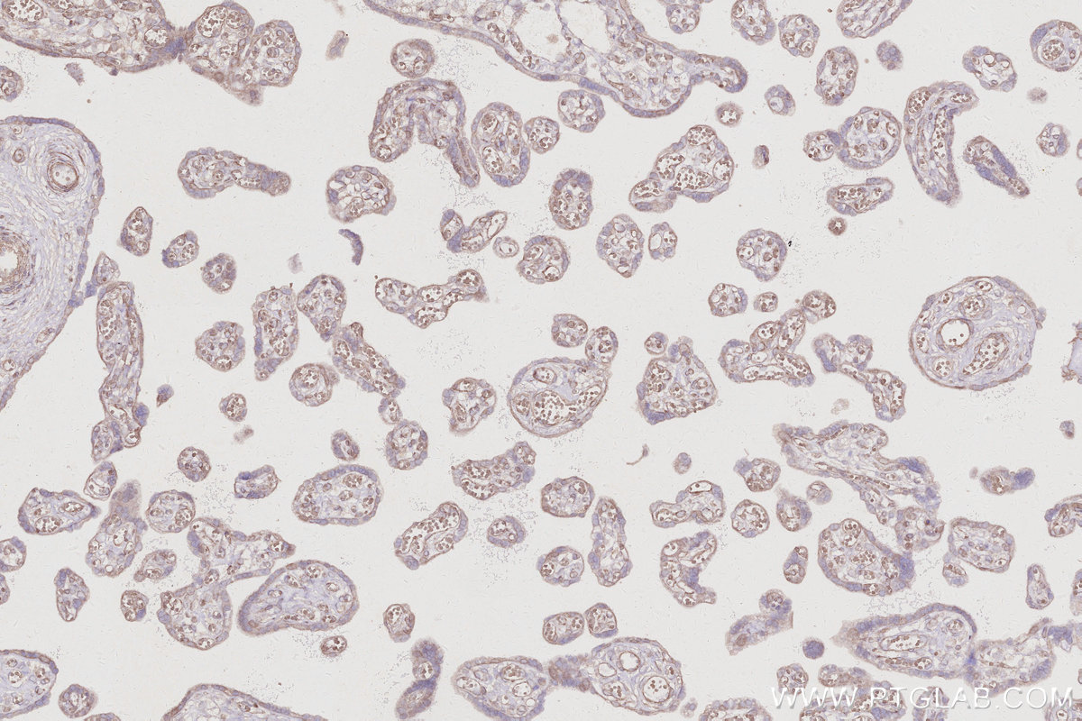 IHC staining of human placenta using 10167-1-AP IHC staining of human placenta using 10167-1-AP