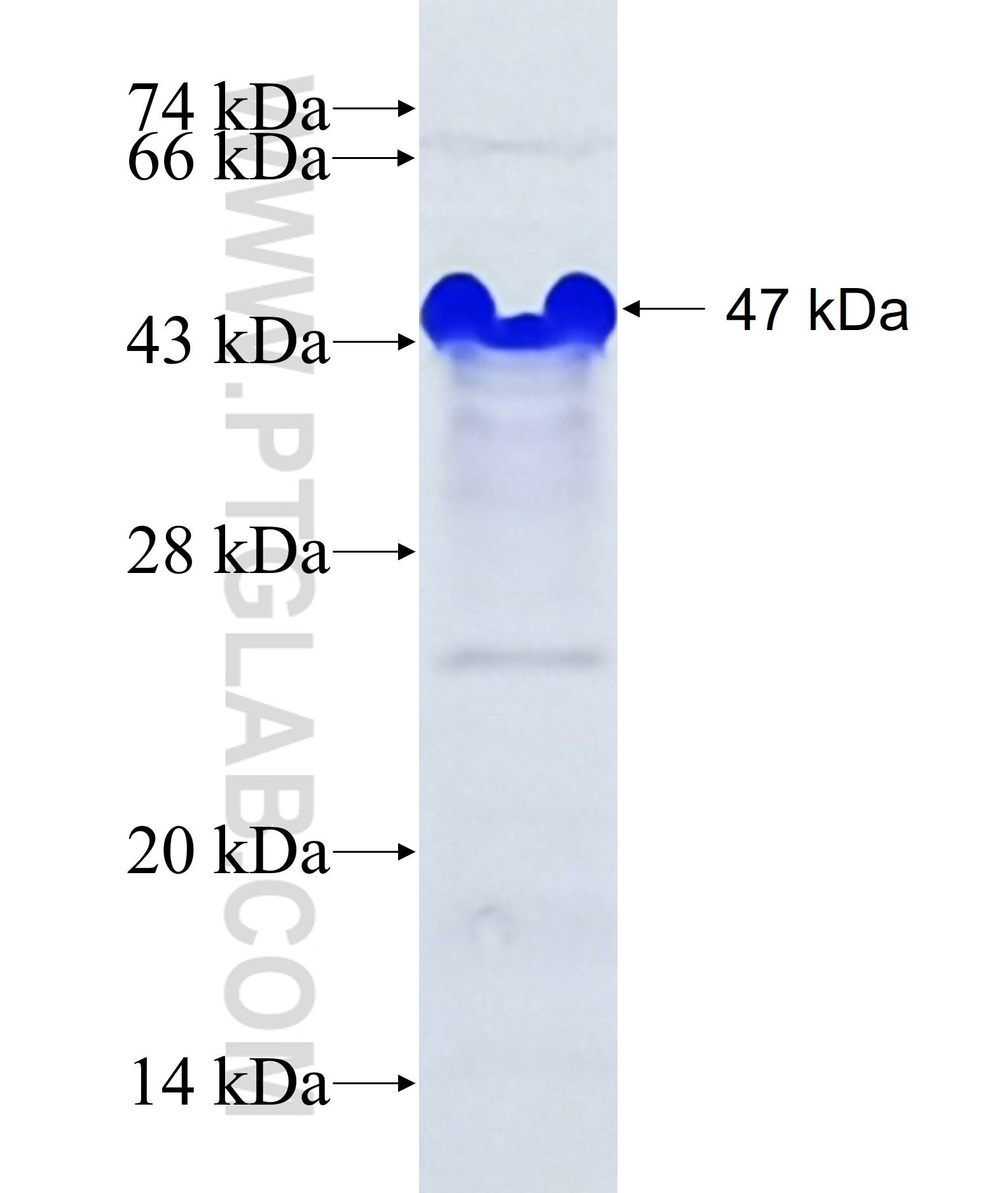 SERTAD2 fusion protein Ag37578 SDS-PAGE