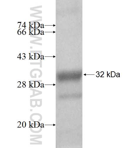 SERTAD3 fusion protein Ag9234 SDS-PAGE SERTAD3 fusion protein Ag9234 SDS-PAGE