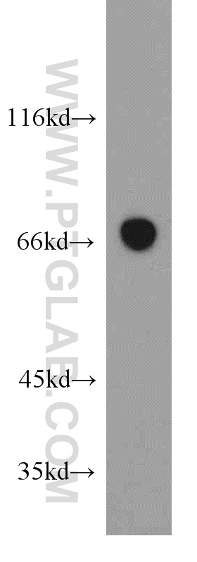 WB analysis of human skeletal muscle using 21668-1-AP