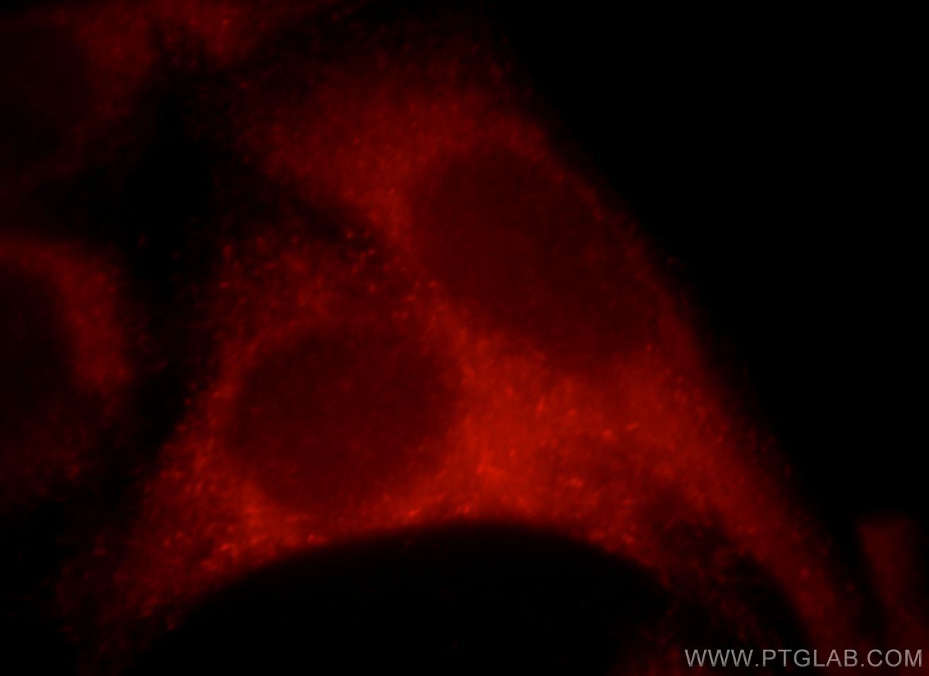 IF Staining of HeLa using 21346-1-AP