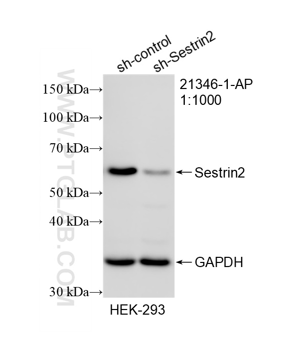 WB analysis of HEK-293 using 21346-1-AP