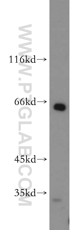 WB analysis of mouse thymus using 21346-1-AP