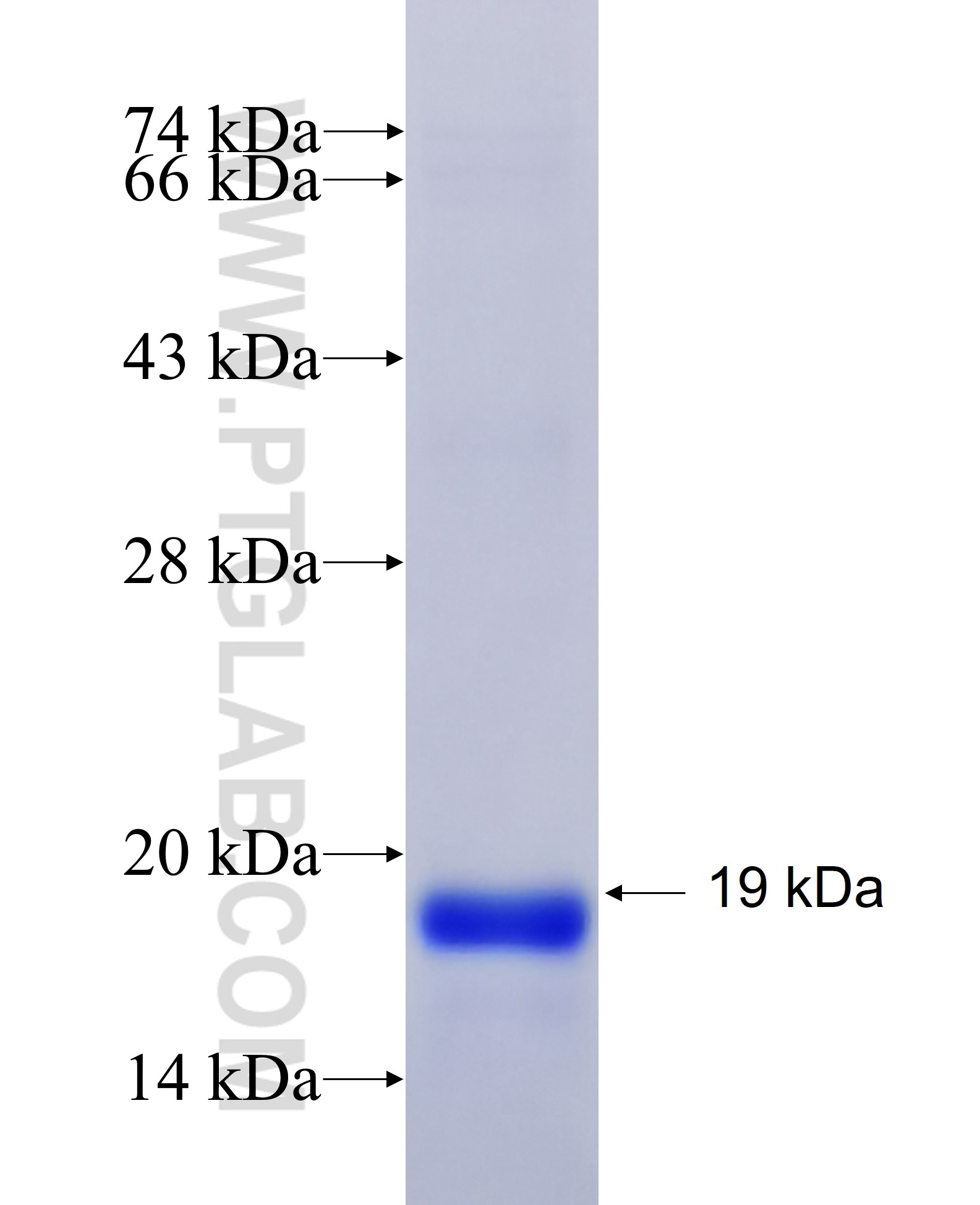 SESN2 fusion protein Ag15873 SDS-PAGE