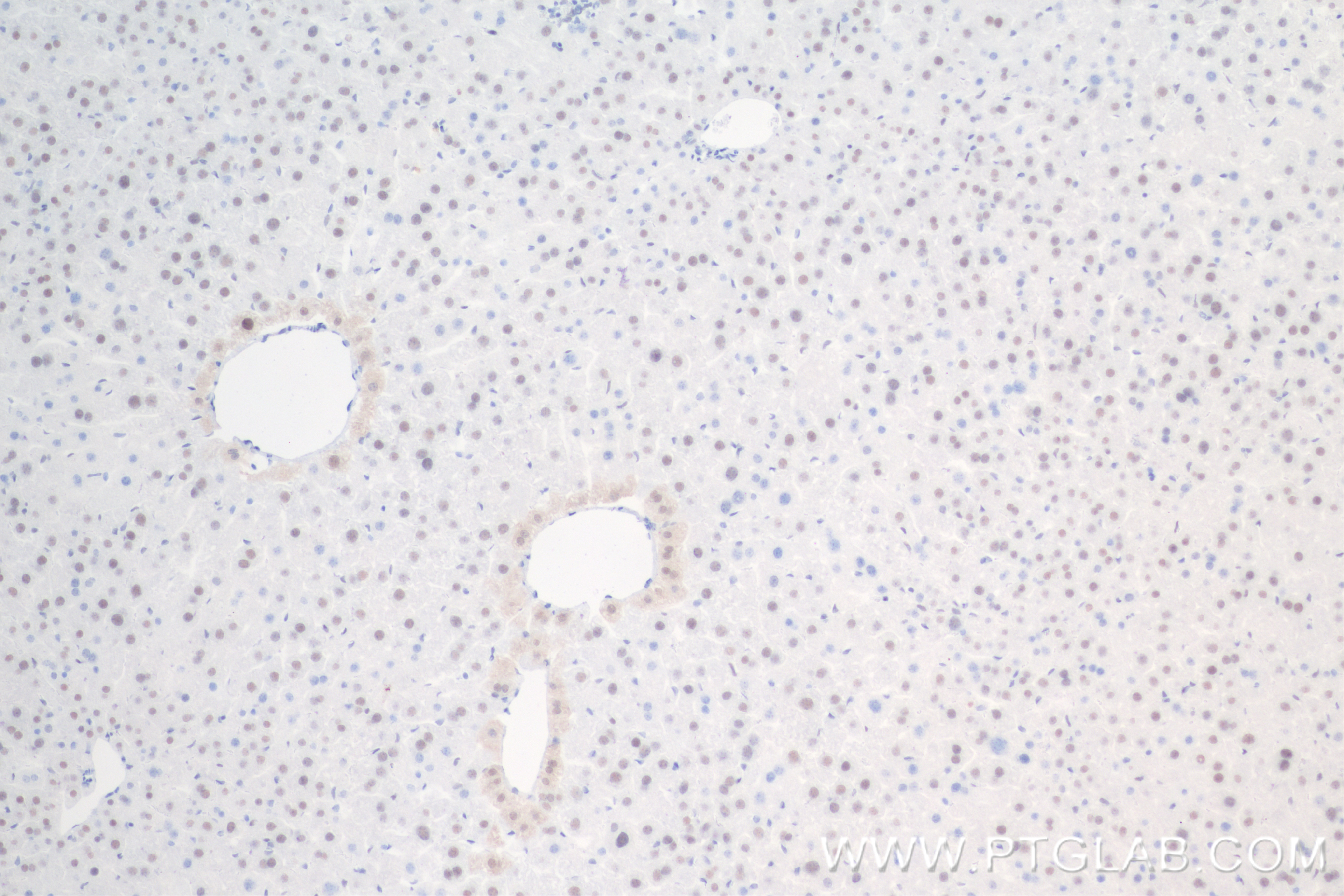 IHC staining of mouse liver using 84823-3-RR