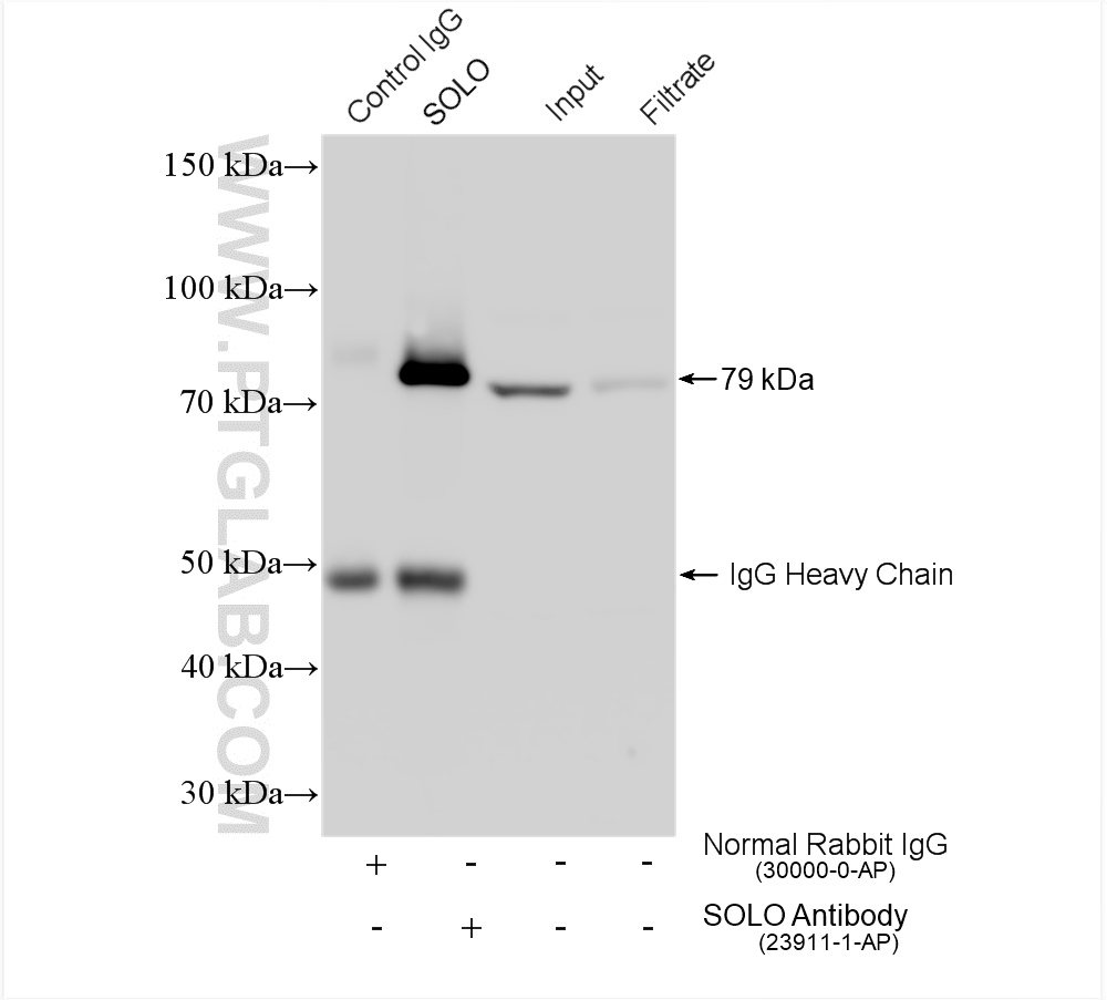 IP experiment of mouse brain using 23911-1-AP