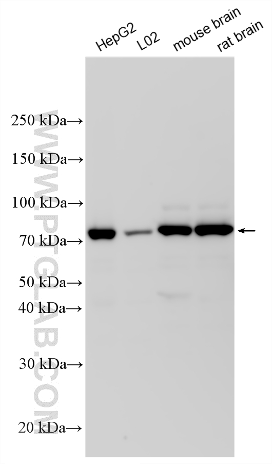 Various lysates were subjected to SDS PAGE followed by western blot with 23911-1-AP (SOLO/SESTD1 antibody) at dilution of 1:10000 incubated at room temperature for 1.5 hours. WB analysis using 23911-1-AP
