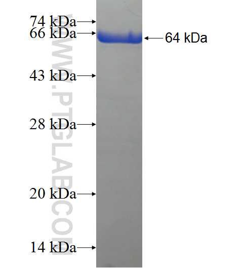 SESTD1 fusion protein Ag21016 SDS-PAGE