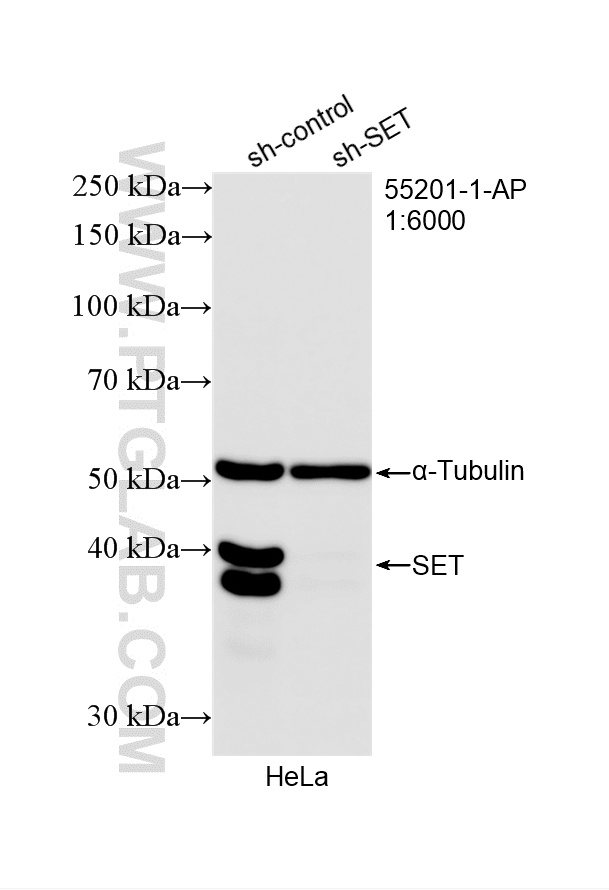 WB analysis of HeLa using 55201-1-AP