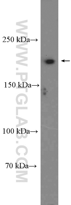 WB analysis of HeLa using 16841-1-AP