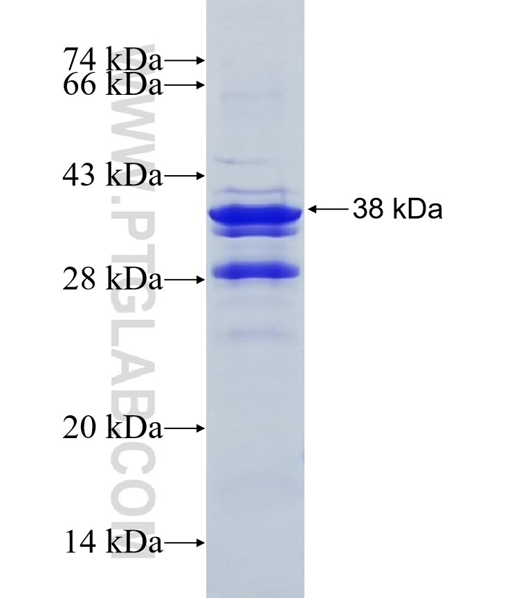 SETBP1 fusion protein Ag10493 SDS-PAGE SETBP1 fusion protein Ag10493 SDS-PAGE