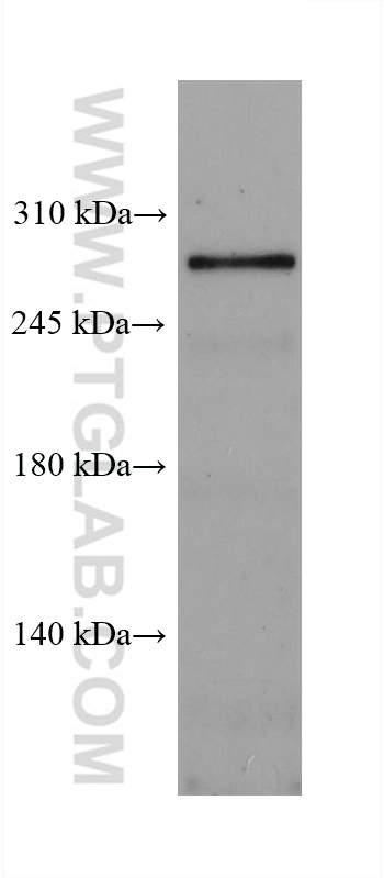 WB analysis of mouse brain using 67936-1-Ig