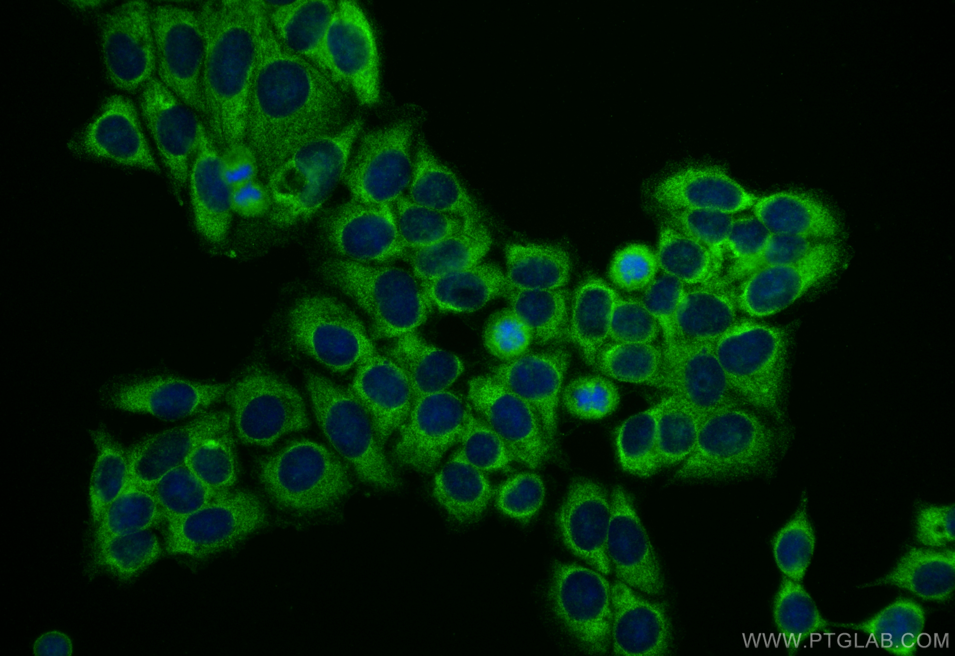 IF Staining of MCF-7 using 28692-1-AP