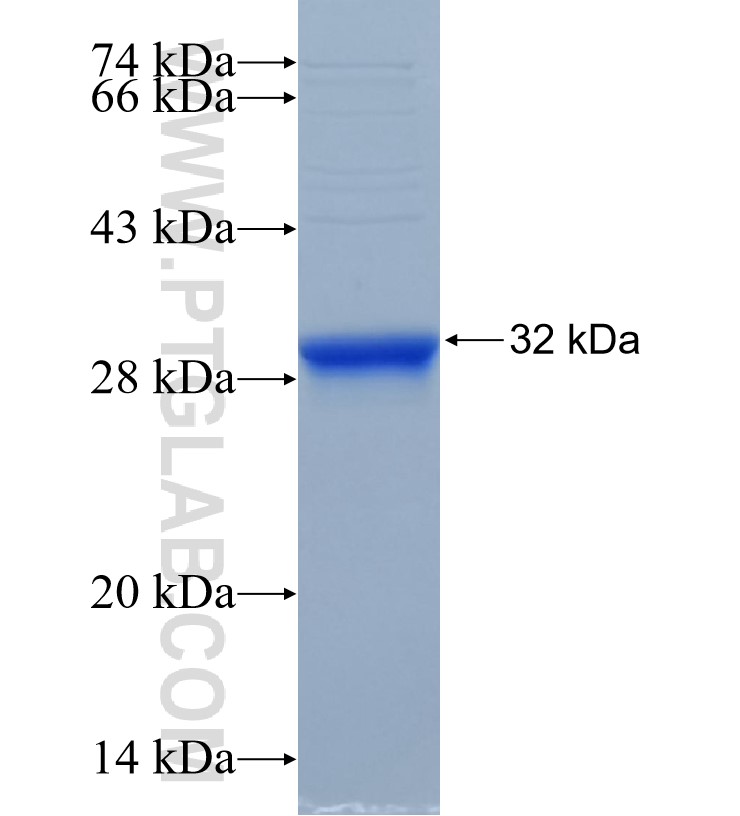 SETD4 fusion protein Ag33842 SDS-PAGE