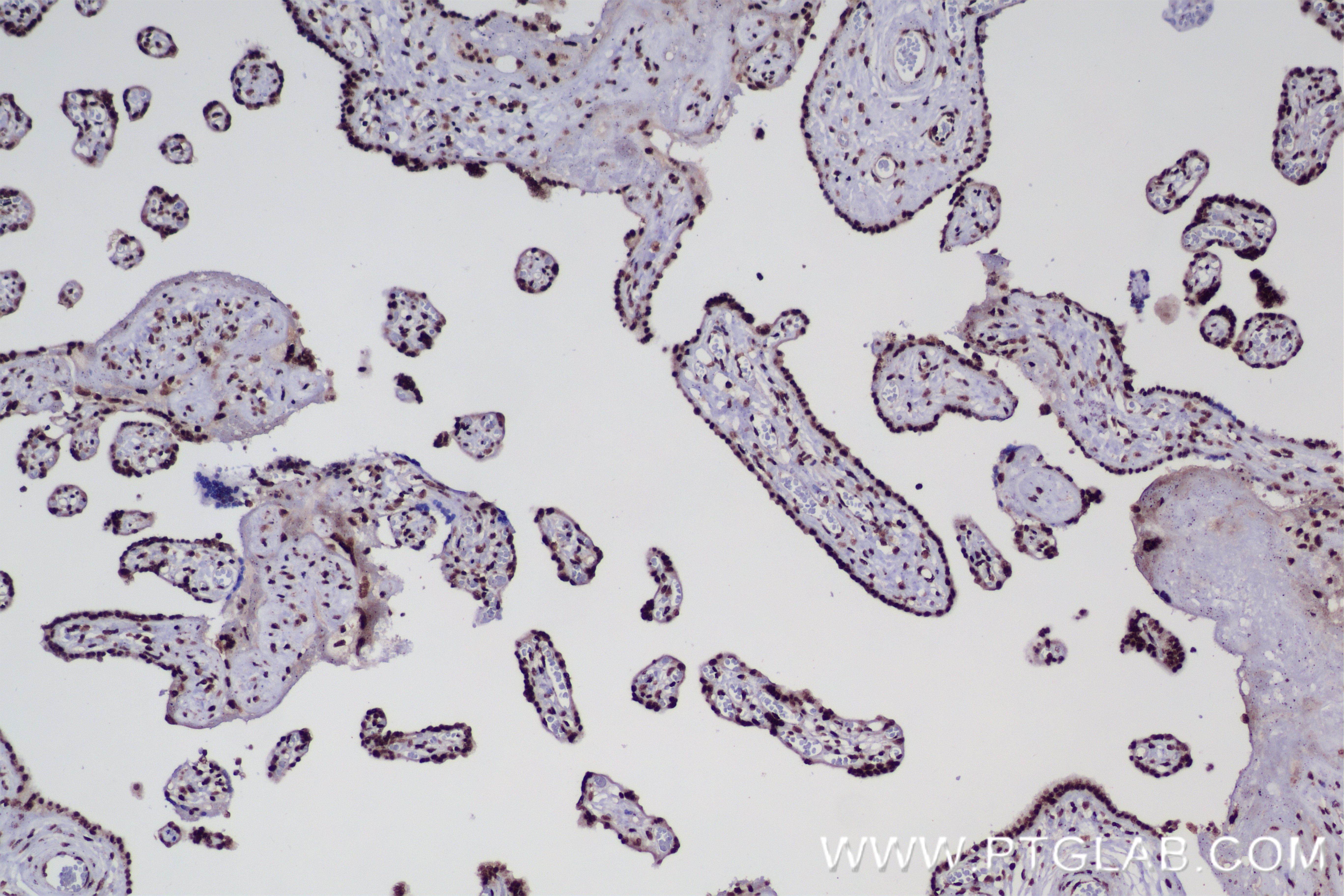 IHC staining of human placenta using 84622-1-RR (same clone as 84622-1-PBS)