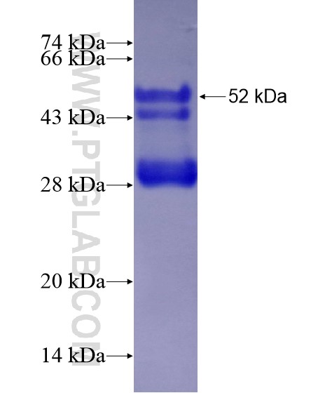 SETD5 fusion protein Ag28920 SDS-PAGE