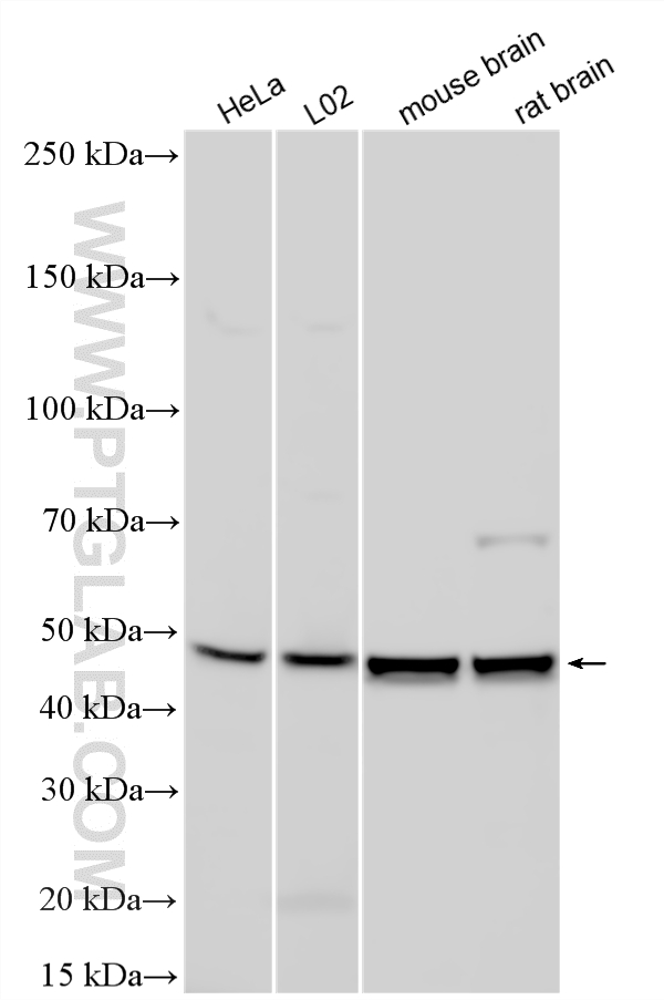 WB analysis using 24840-1-AP WB analysis using 24840-1-AP