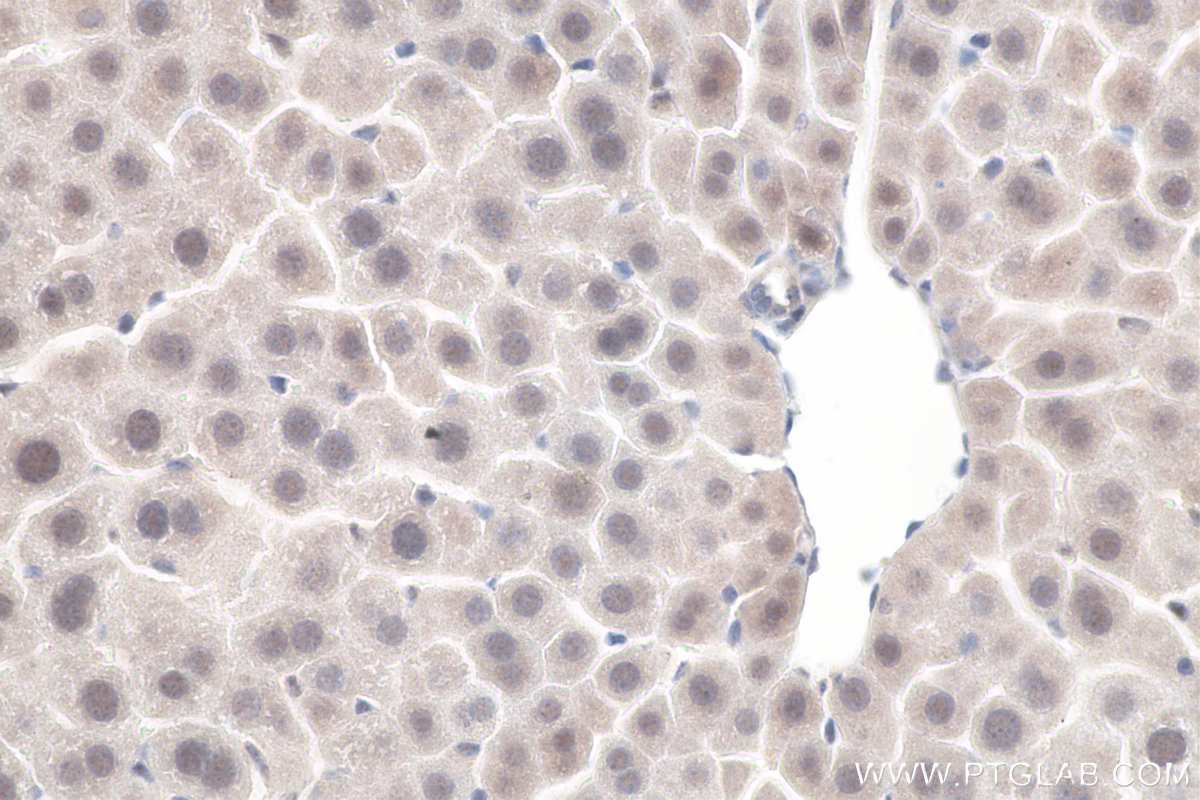 IHC staining of mouse liver using 11231-1-AP IHC staining of mouse liver using 11231-1-AP