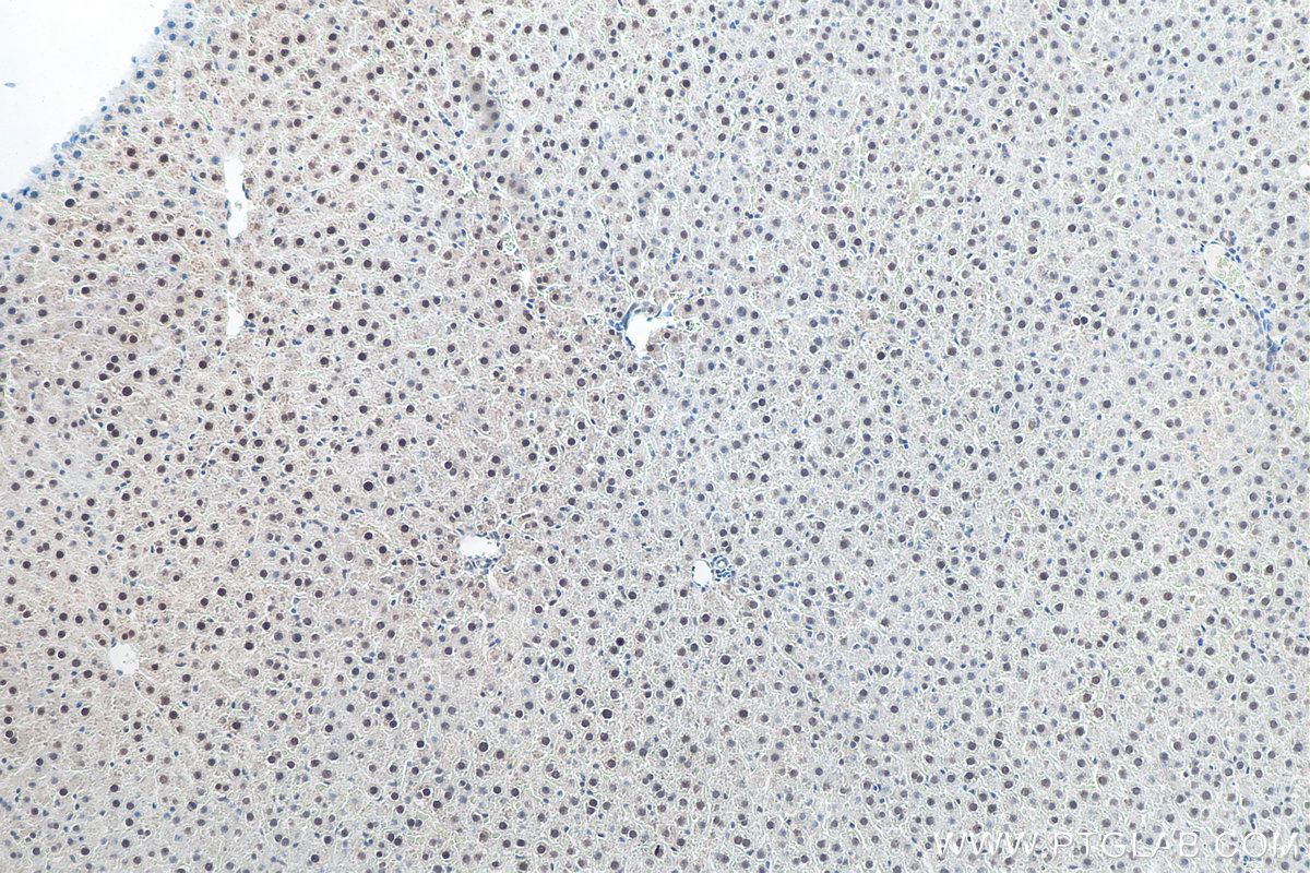 IHC staining of rat liver using 11231-1-AP IHC staining of rat liver using 11231-1-AP