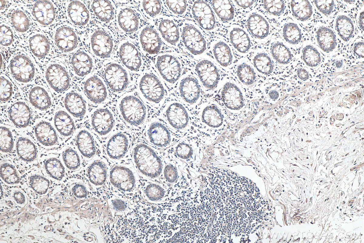 IHC staining of human colon using 66293-1-Ig (same clone as 66293-1-PBS)