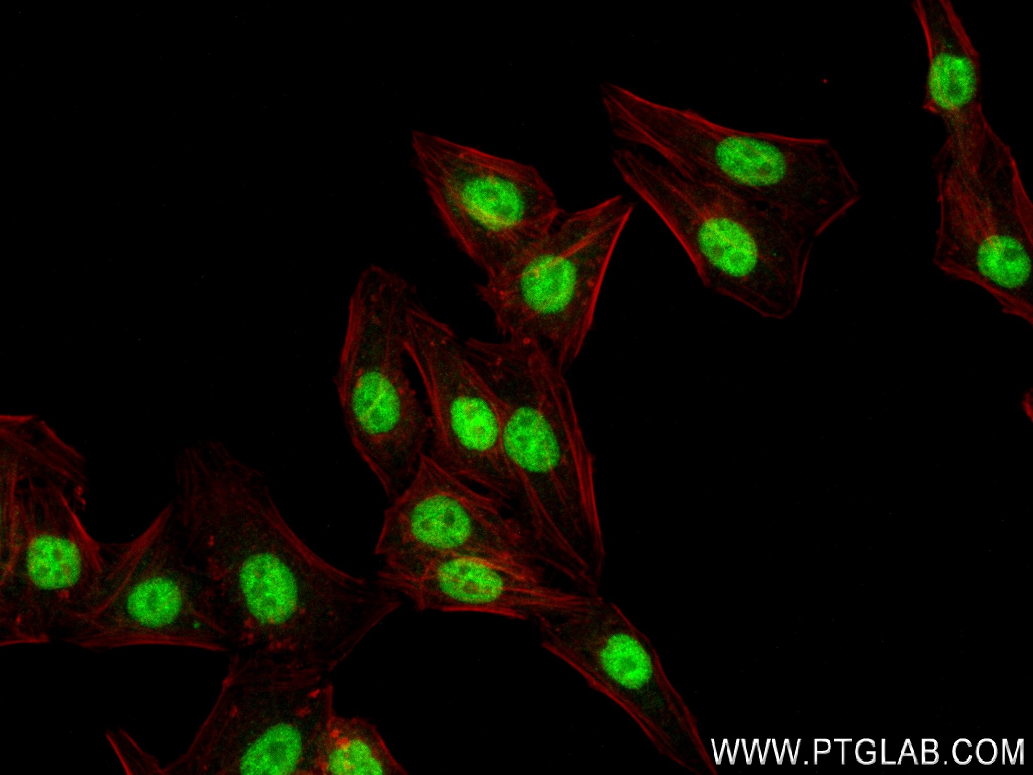 IF Staining of HepG2 using 83772-6-RR (same clone as 83772-6-PBS)