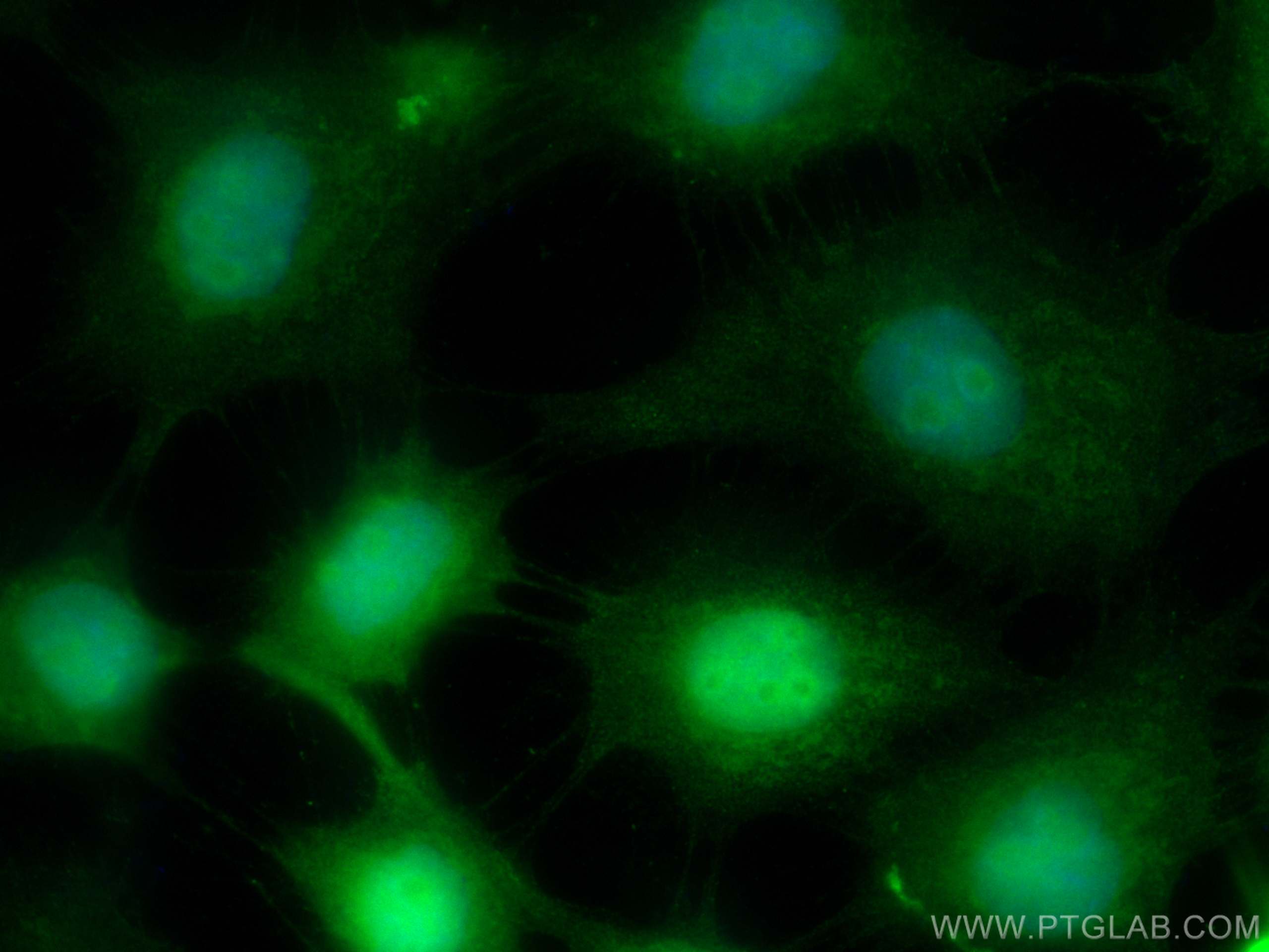 IF Staining of A431 using CL488-66293
