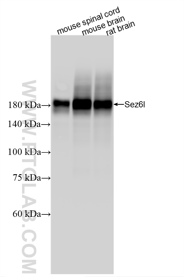 WB analysis using 87923-1-RR (same clone as 87923-1-PBS)