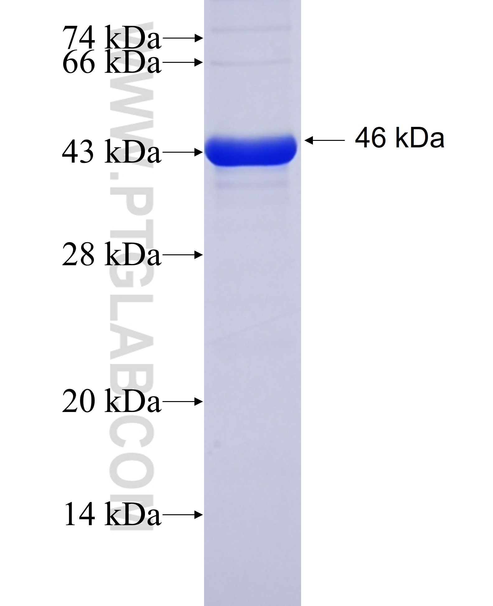 SEZ6L2 fusion protein Ag13796 SDS-PAGE