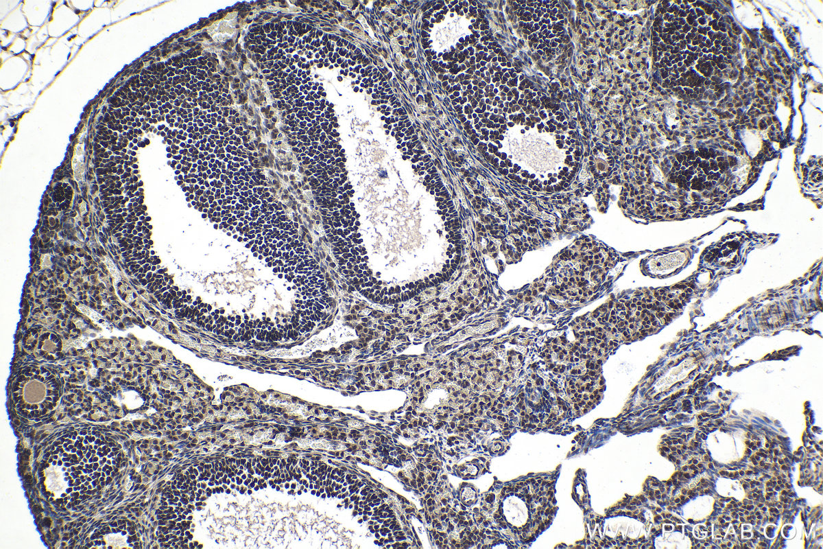 IHC staining of mouse ovary using 11635-1-AP (same clone as 11635-1-PBS)