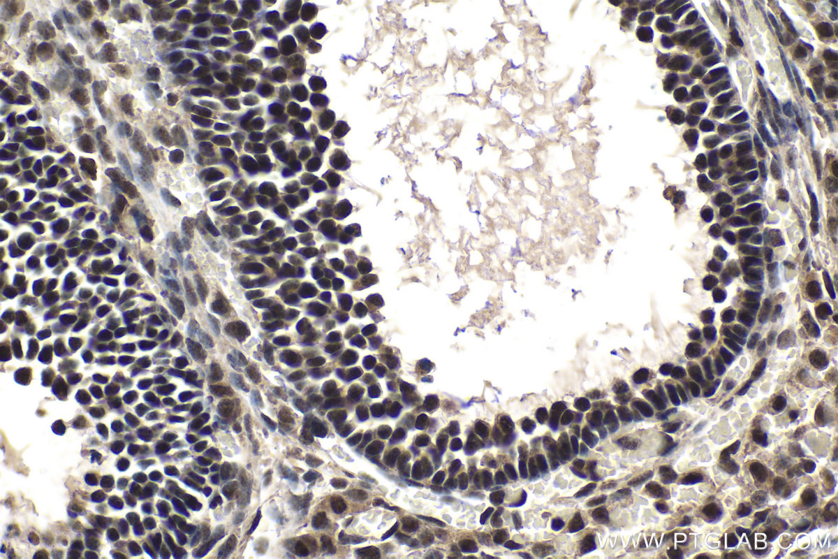 IHC staining of mouse ovary using 11635-1-AP
