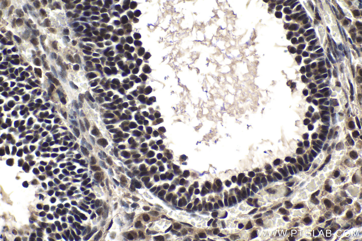IHC staining of mouse ovary using 11635-1-AP (same clone as 11635-1-PBS)