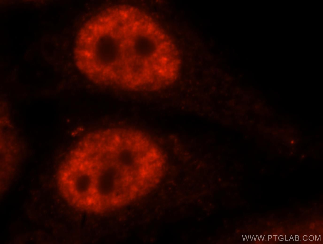 IF Staining of HepG2 using 15858-1-AP