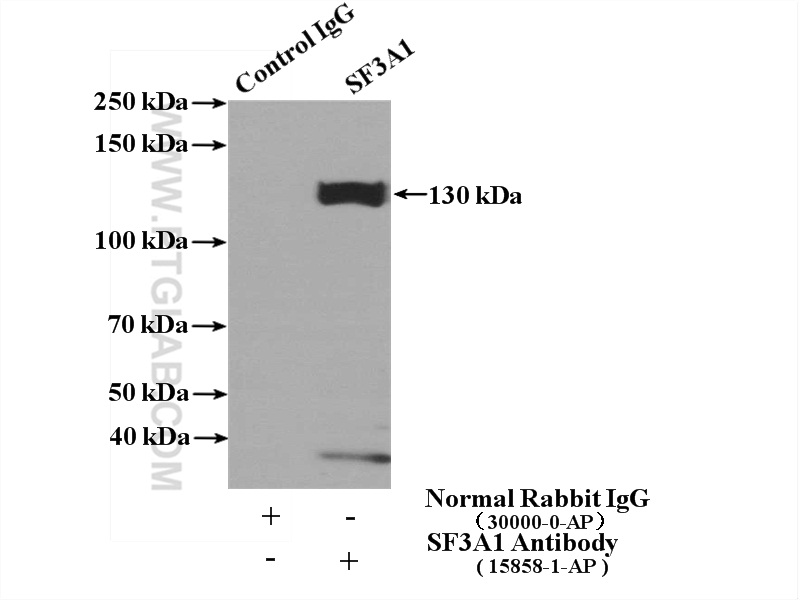 IP experiment of mouse brain using 15858-1-AP