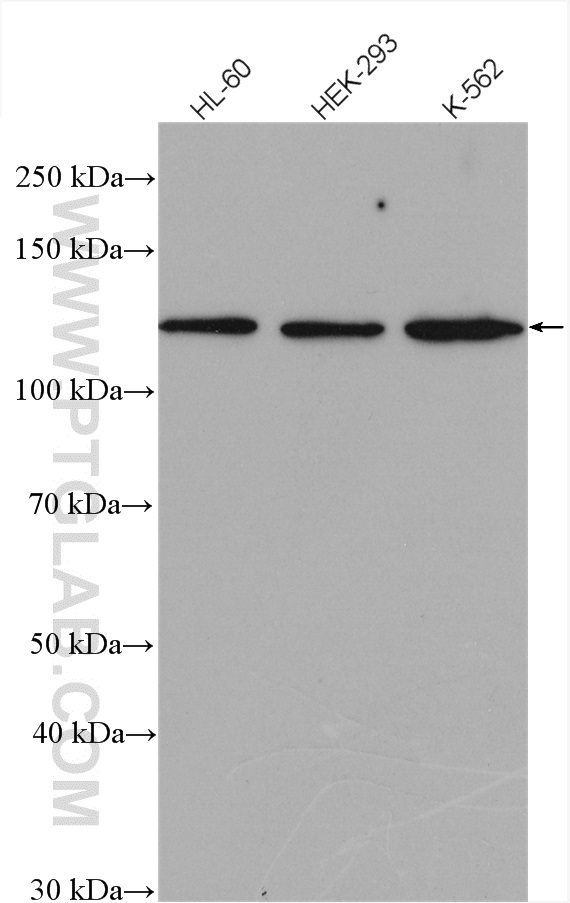 WB analysis using 15858-1-AP