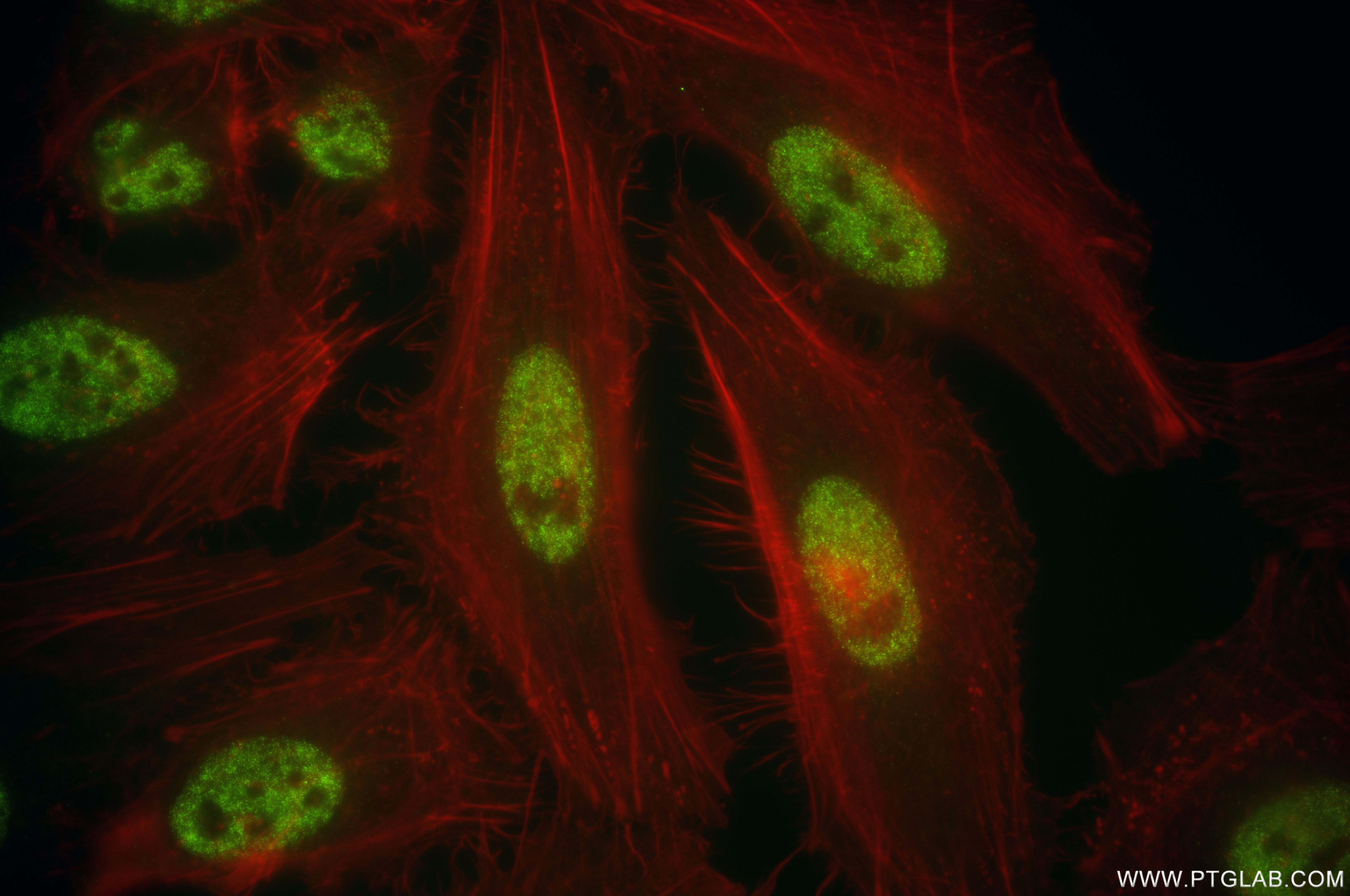 IF Staining of HeLa using 86170-2-RR (same clone as 86170-2-PBS)