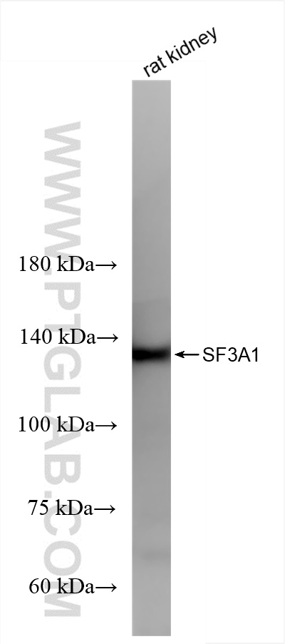WB analysis of rat kidney using 86170-2-RR (same clone as 86170-2-PBS)