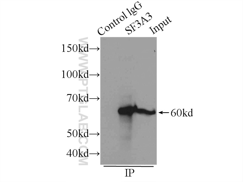 IP experiment of Raji using 12070-1-AP