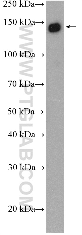 WB analysis of MCF-7 using 27684-1-AP