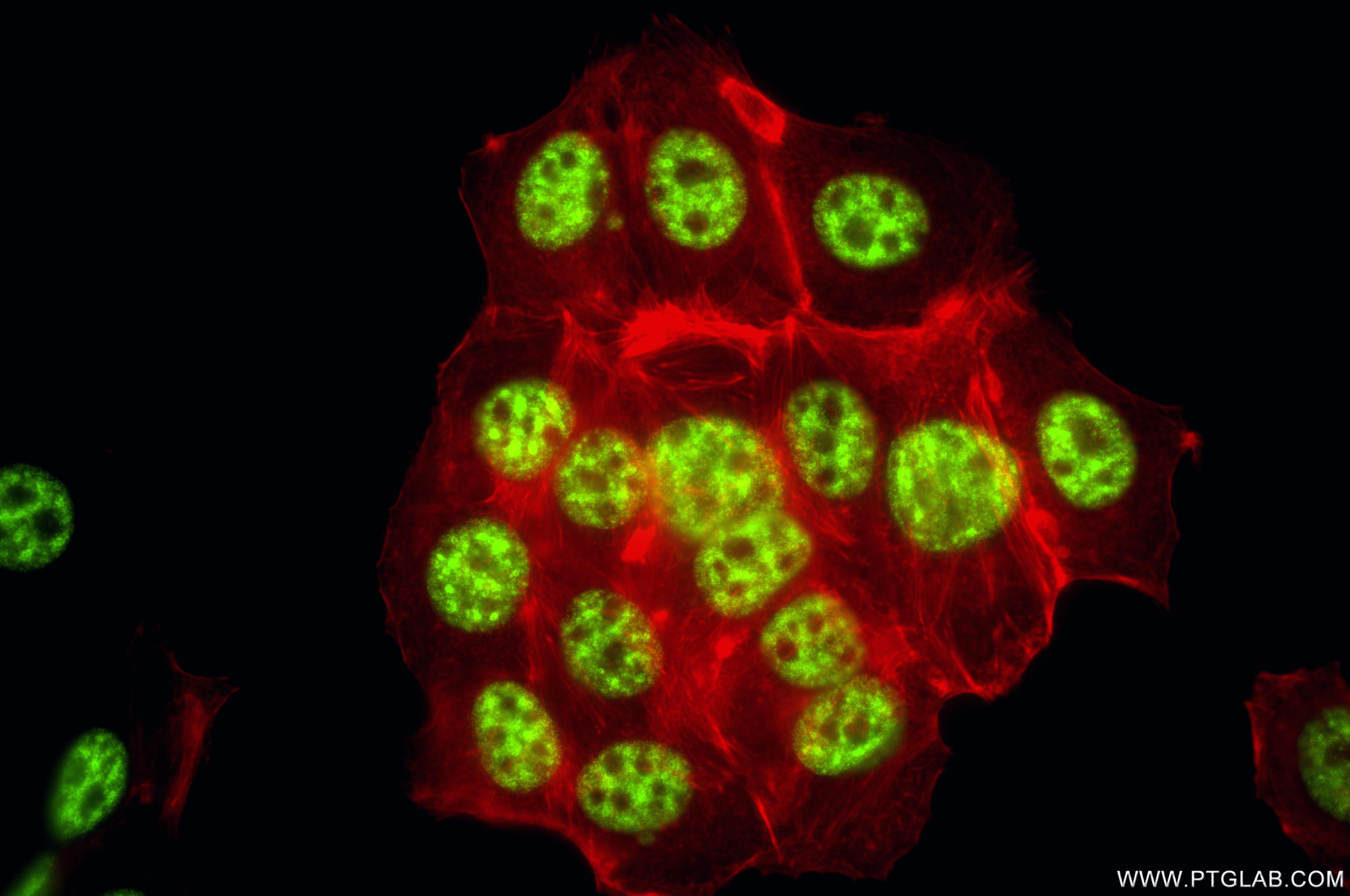 IF Staining of MCF-7 using 85640-4-RR