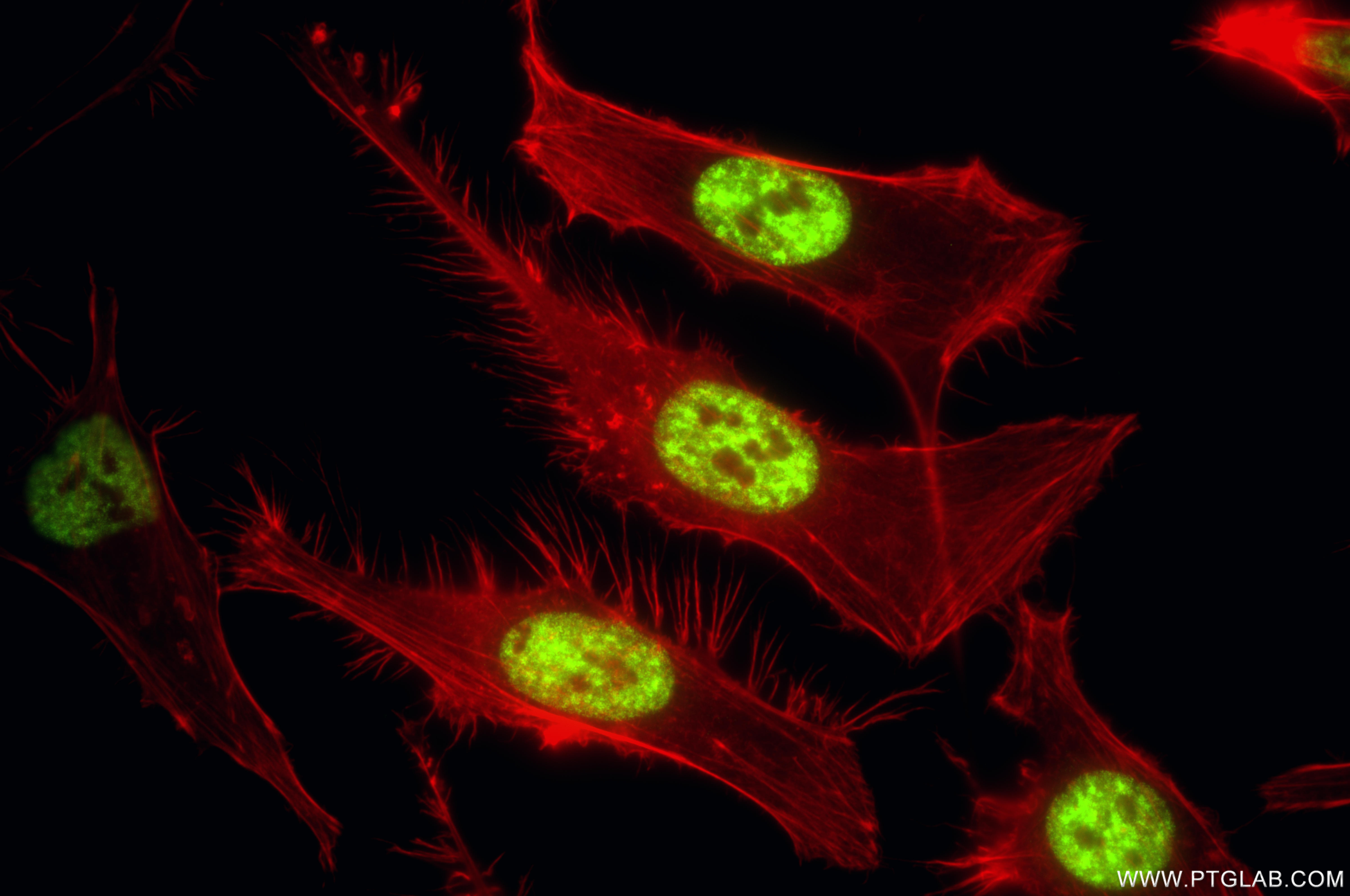 IF Staining of HeLa using 85640-4-RR