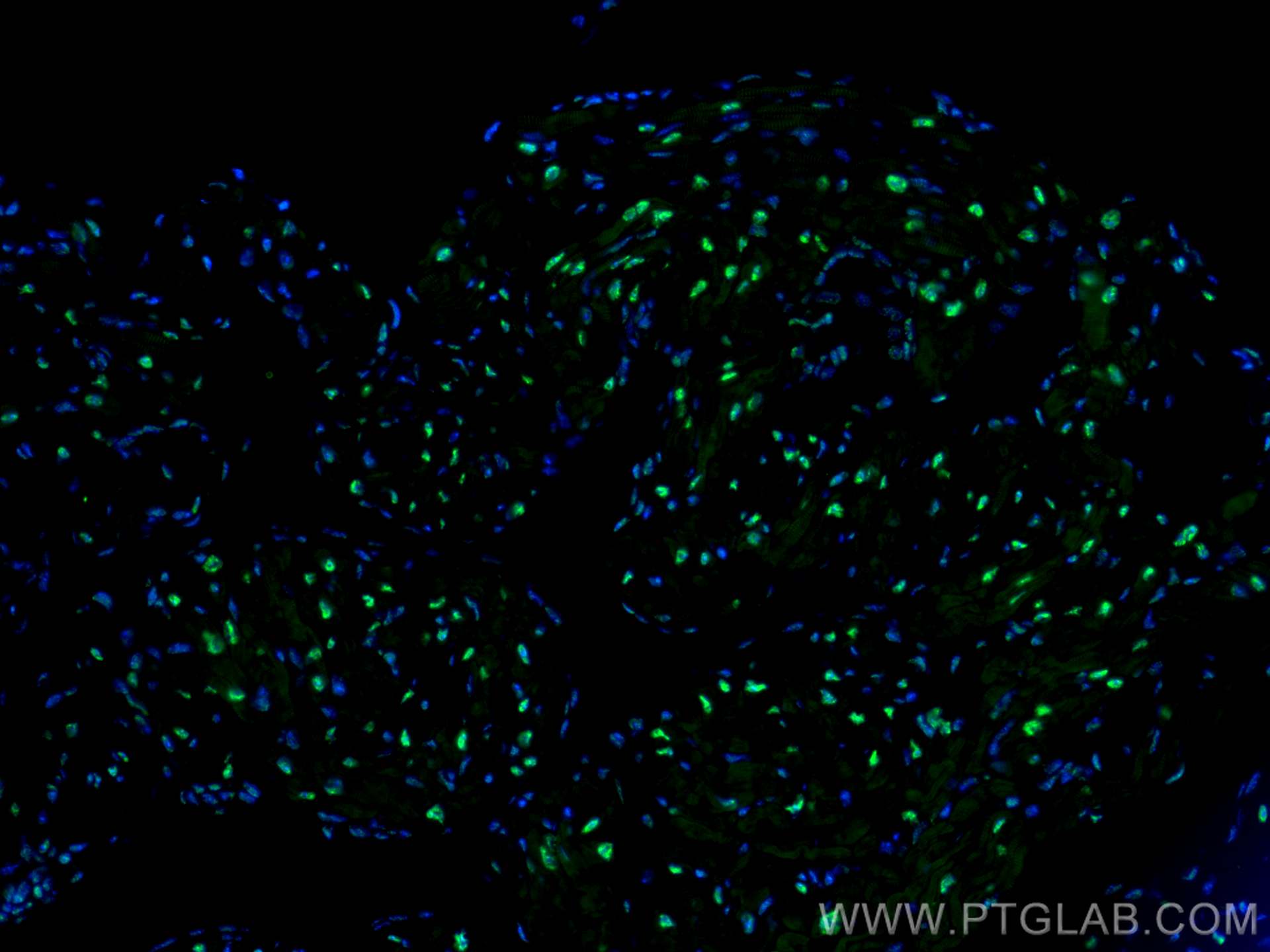 IF Staining of mouse heart using 14577-1-AP