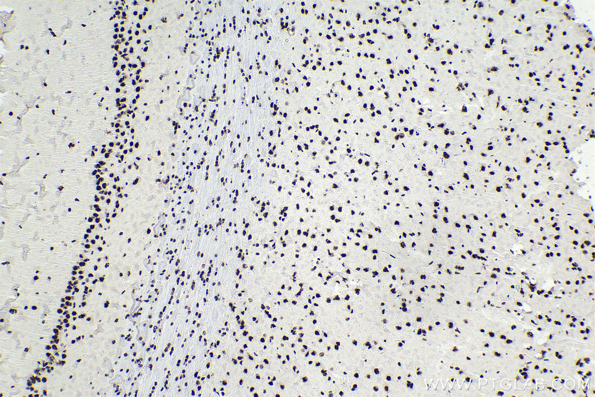 IHC staining of rat brain using 14577-1-AP