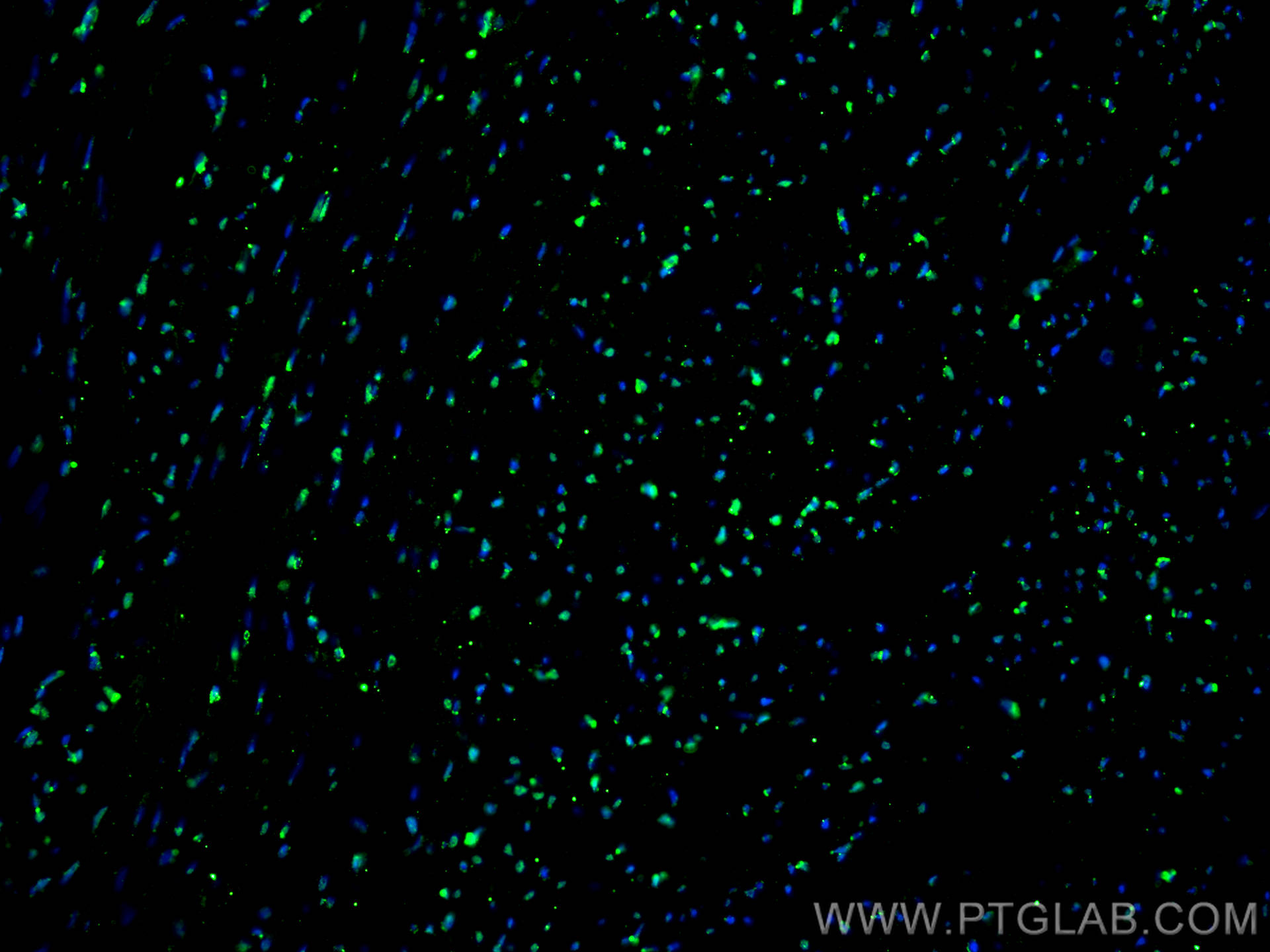 IF Staining of rat heart using 67469-1-Ig (same clone as 67469-1-PBS)