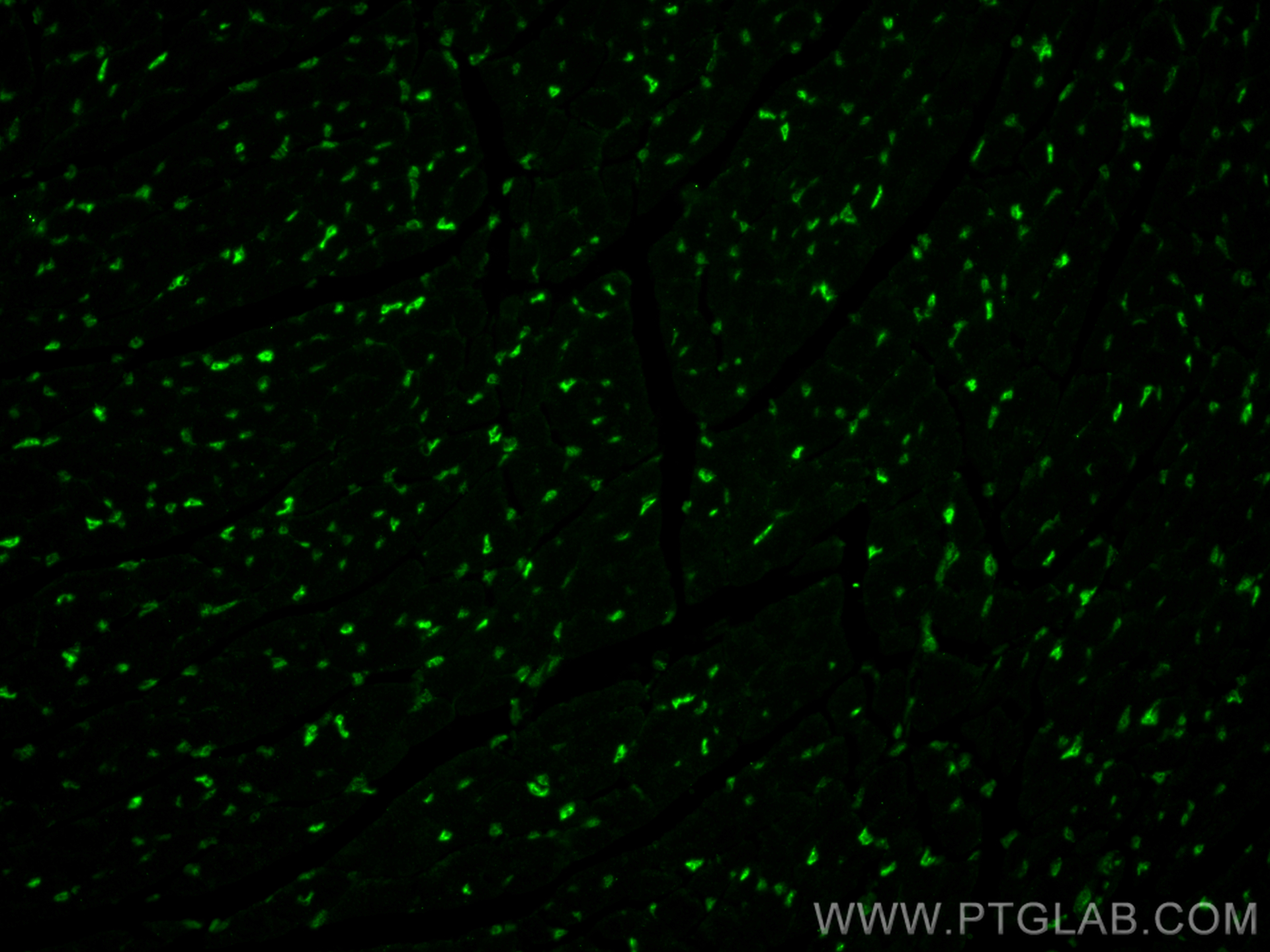 IF Staining of mouse heart using 67469-1-Ig (same clone as 67469-1-PBS)